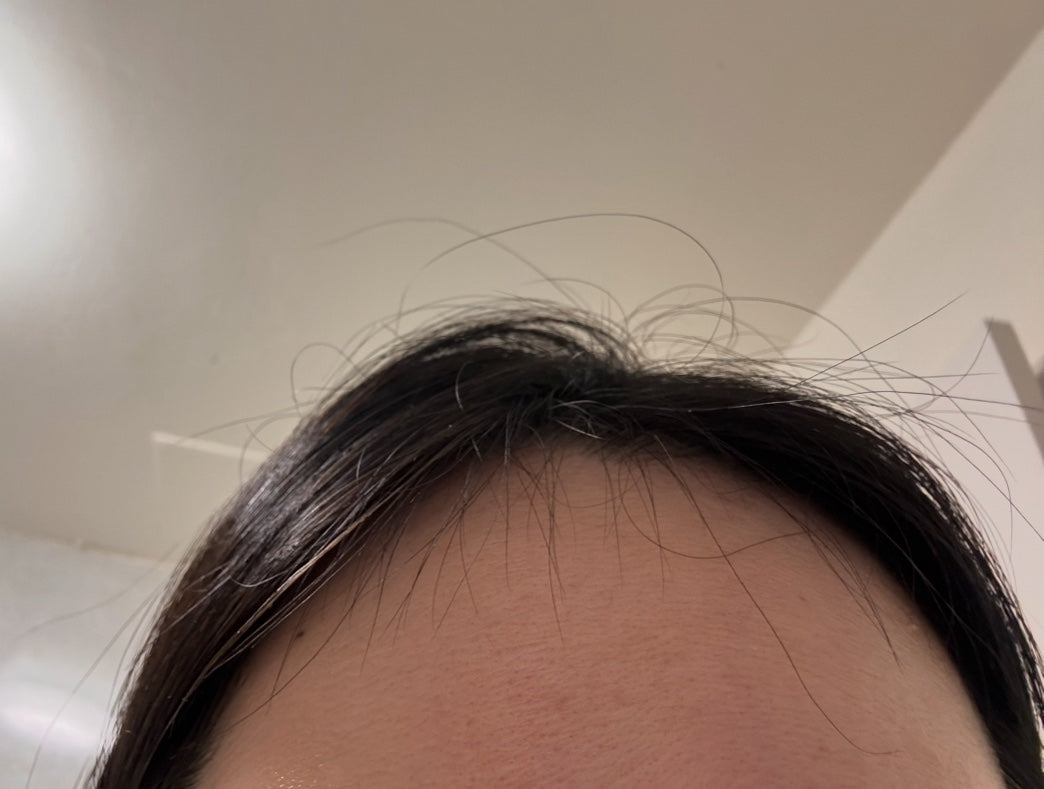 Wasn’t expecting this, new hairs showing up!